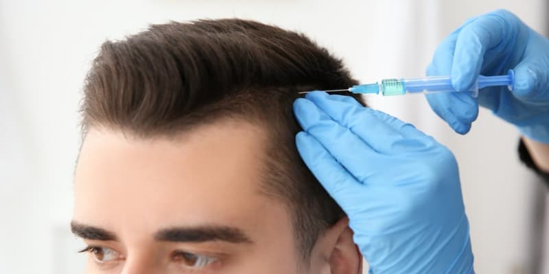 Hair Transplant – Achieve Natural-Looking, Permanent Results