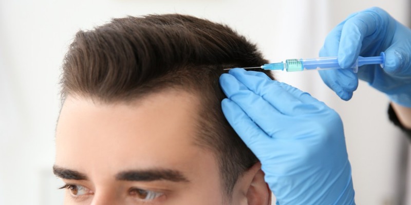Hair Transplant – Achieve Natural-Looking, Permanent Results