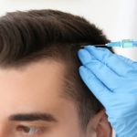 Hair Transplant – Achieve Natural-Looking, Permanent Results